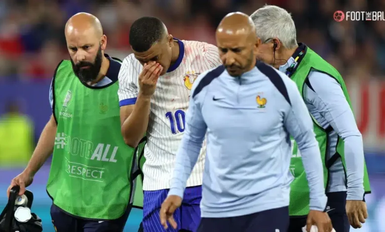 Mbappe to Wear Custom Mask After Suffering Nose Break 1 Untitleddesign ezgif.com png to webp converter